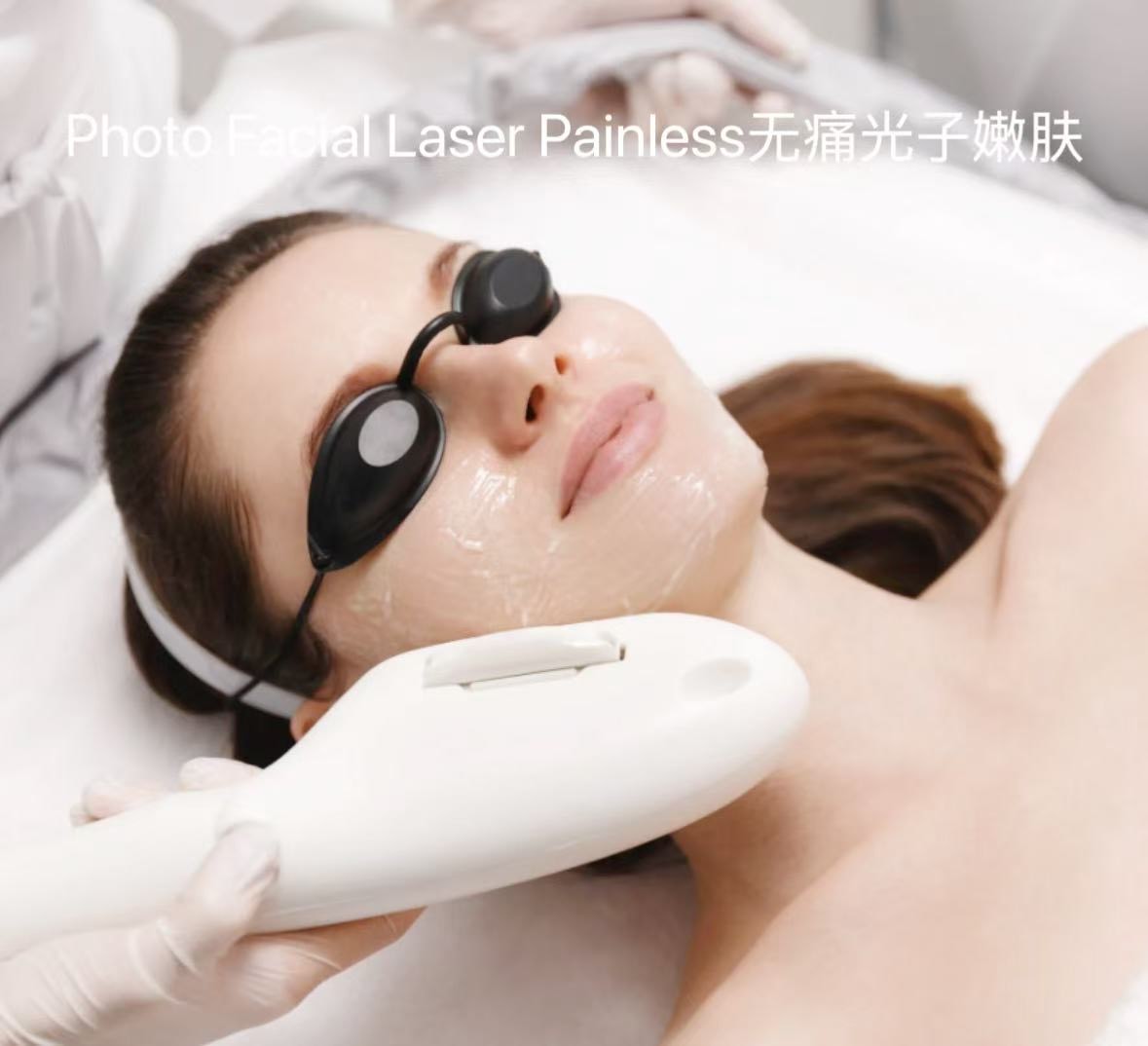 photo facial
